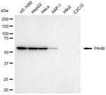 PDI Antibody in Western Blot (WB)