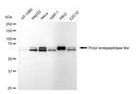 PREPL Antibody in Western Blot (WB)