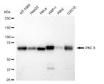 PKC delta Recombinant Rabbit Monoclonal Antibody (24GB4485)
