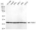 PSMA1 Recombinant Rabbit Monoclonal Antibody (24GB1610)