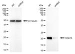 RAB7 Antibody in Western Blot (WB)