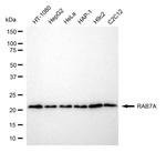 RAB7 Antibody in Western Blot (WB)