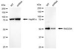 RAD23A Antibody in Western Blot (WB)