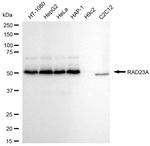 RAD23A Antibody in Western Blot (WB)
