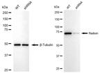 Radixin Antibody in Western Blot (WB)