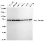 Radixin Antibody in Western Blot (WB)