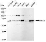 RelB Antibody in Western Blot (WB)