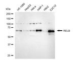 RelB Recombinant Rabbit Monoclonal Antibody (24GB5070)