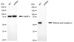 RARA Antibody in Western Blot (WB)