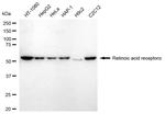 RARA Antibody in Western Blot (WB)