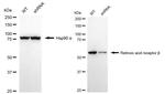 RARB Antibody in Western Blot (WB)