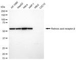 RARB Antibody in Western Blot (WB)