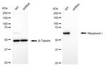 Ribophorin I Antibody in Western Blot (WB)