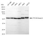 RPS6KB2 Antibody in Western Blot (WB)