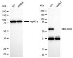 RPS6KB2 Antibody in Western Blot (WB)