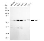 RPS6KB2 Recombinant Rabbit Monoclonal Antibody (24GB5075)
