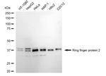 RNF2 Recombinant Rabbit Monoclonal Antibody (24GB5455)