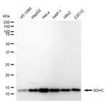 SDHC Antibody in Western Blot (WB)