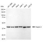 Septin 2 Antibody in Western Blot (WB)