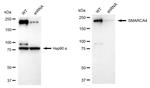 BRG1 Antibody in Western Blot (WB)
