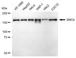 SMC4 Antibody in Western Blot (WB)