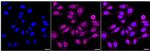 SMCHD1 Recombinant Rabbit Monoclonal Antibody (24GB2385)