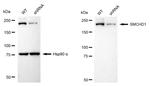 SMCHD1 Antibody in Western Blot (WB)