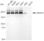 SMCHD1 Antibody in Western Blot (WB)