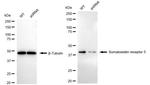 SSTR5 Antibody in Western Blot (WB)