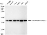 SSTR5 Antibody in Western Blot (WB)