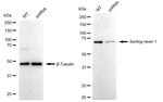 SNX1 Antibody in Western Blot (WB)