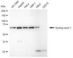 SNX1 Antibody in Western Blot (WB)