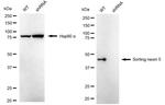 SNX5 Antibody in Western Blot (WB)
