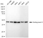 SNX5 Recombinant Rabbit Monoclonal Antibody (24GB2310)