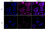 STAT5 beta Antibody in Immunocytochemistry (ICC/IF)