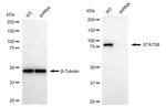 STAT5 beta Antibody in Western Blot (WB)