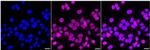UNC84A Antibody in Immunocytochemistry (ICC/IF)