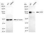 UNC84A Antibody in Western Blot (WB)