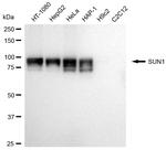 UNC84A Antibody in Western Blot (WB)