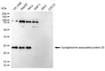 SNAP25 Antibody in Western Blot (WB)
