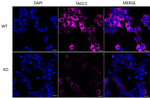 TACC3 Antibody in Immunocytochemistry (ICC/IF)