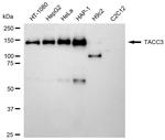 TACC3 Recombinant Rabbit Monoclonal Antibody (24GB1940)