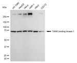 TBK1 Antibody in Western Blot (WB)