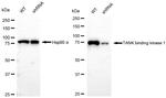 TBK1 Antibody in Western Blot (WB)