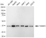 TRBP Antibody in Western Blot (WB)