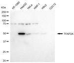 AP2 alpha Antibody in Western Blot (WB)