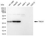 TREX1 Antibody in Western Blot (WB)