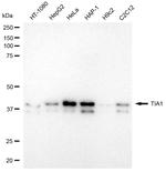 TIA-1 Recombinant Rabbit Monoclonal Antibody (24GB2175)