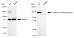 TIMELESS Antibody in Western Blot (WB)