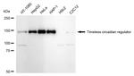 TIMELESS Antibody in Western Blot (WB)